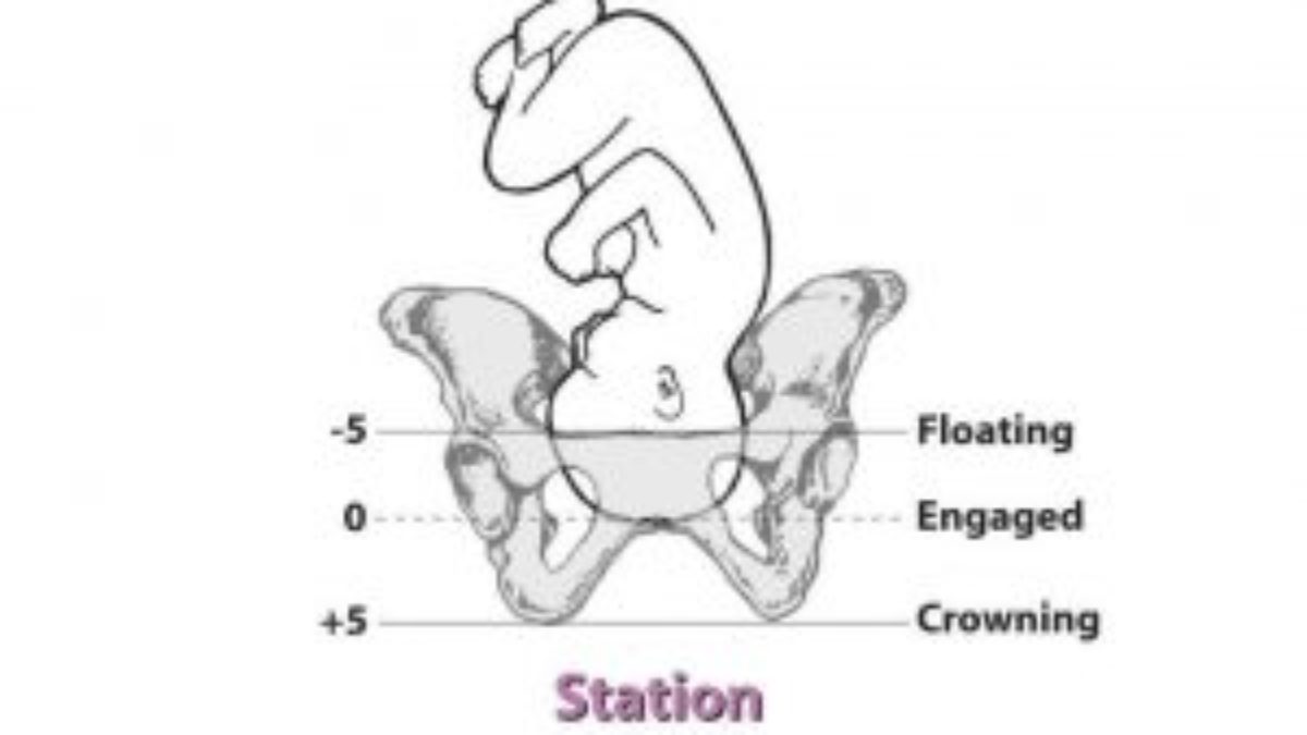 What To Expect For Your Delivery Myfrenchphysio