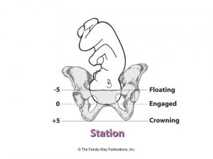 What To Expect For Your Delivery Myfrenchphysio