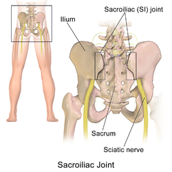 Sacroiliac Joint post pregnancy pain