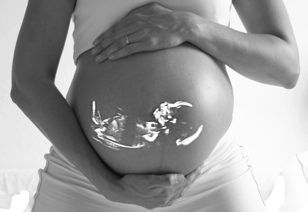 How Physiotherapy Can Save Your Pregnancy?