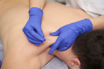 Dry needling for shoulder and upper back pain